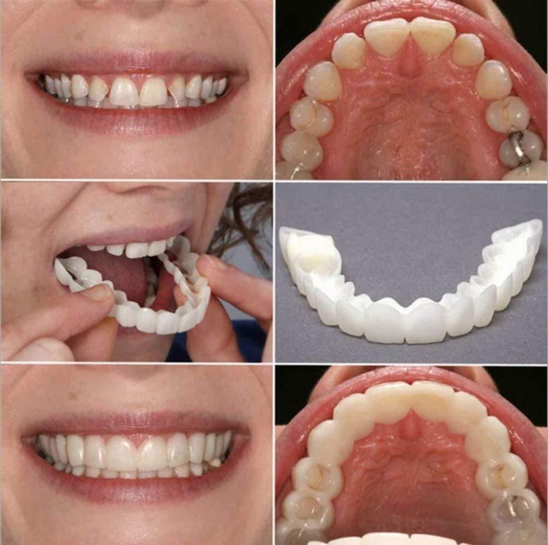 😍🦷Instant and Confident on Smile Fit Flex Cosmetic Teeth Denture Teeth😍🦷