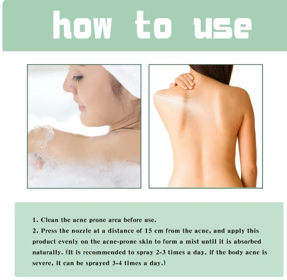 Back Acne Treatment Spray