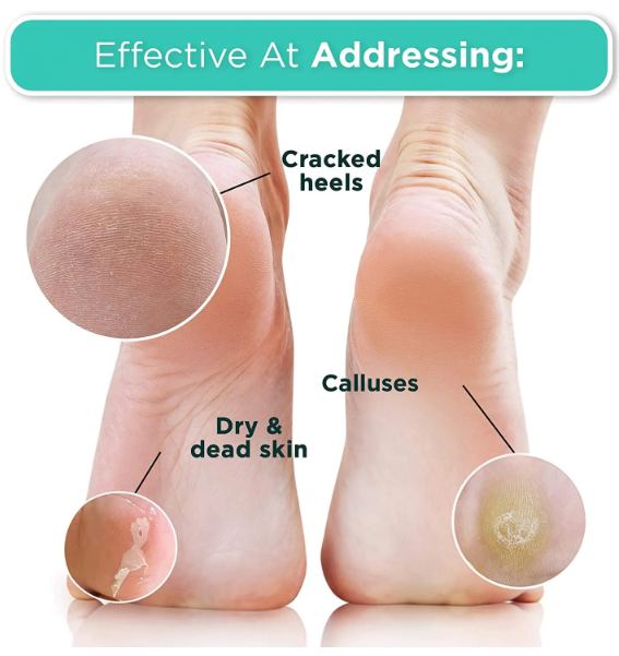 Exfoliating Hydrating Foot Mask Pedicure Sock