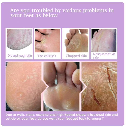 Exfoliating Hydrating Foot Mask Pedicure Sock