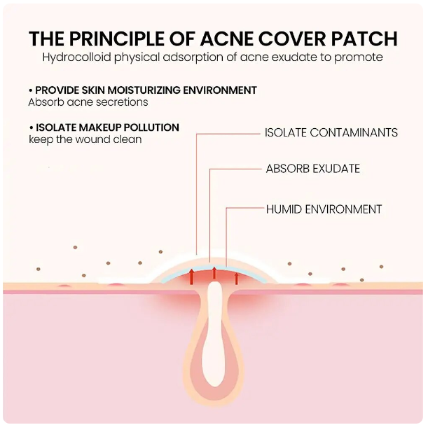 Acne Pimple Patch