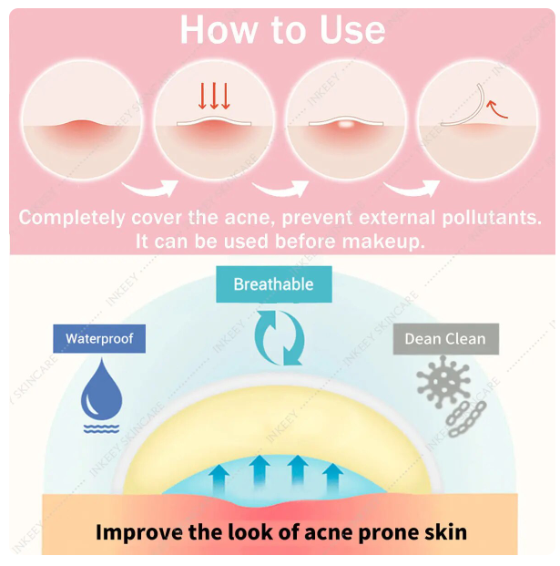 Acne Pimple Patch