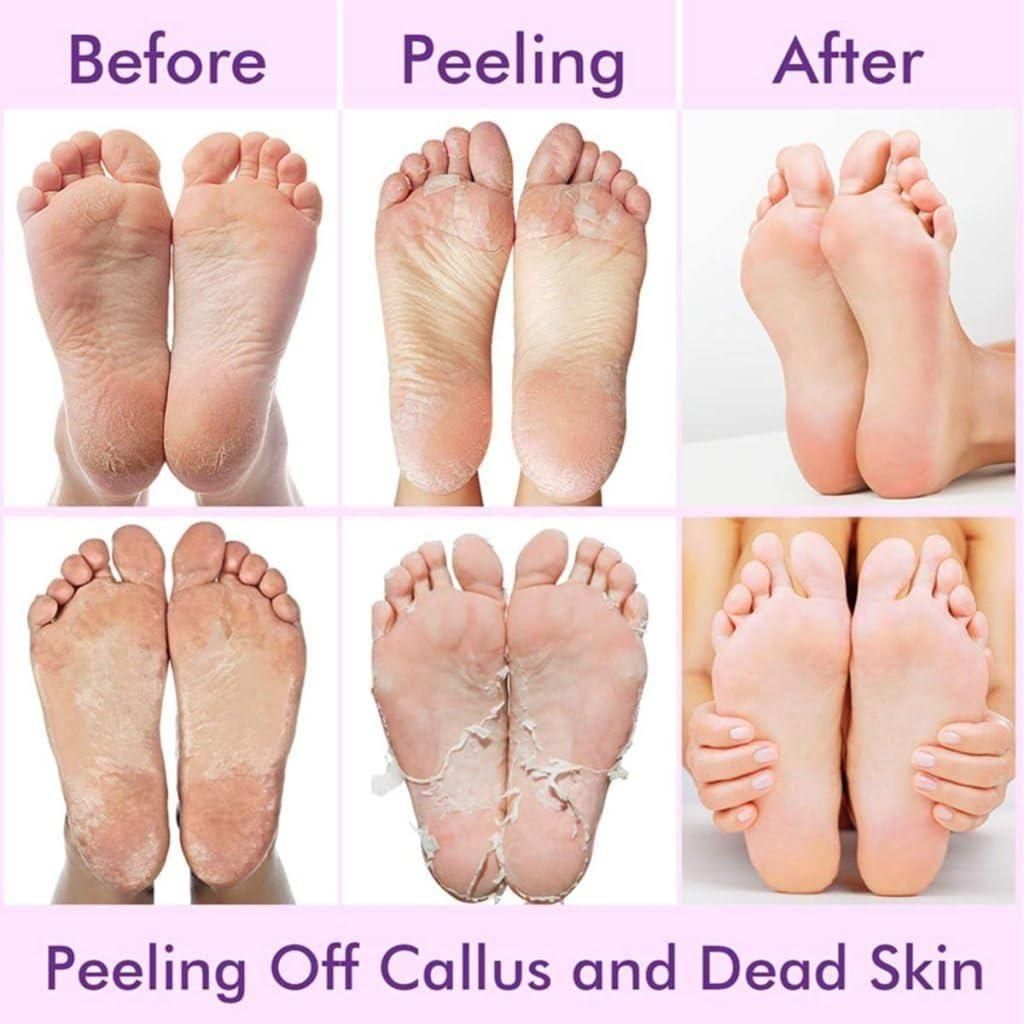 Exfoliating Hydrating Foot Mask Pedicure Sock