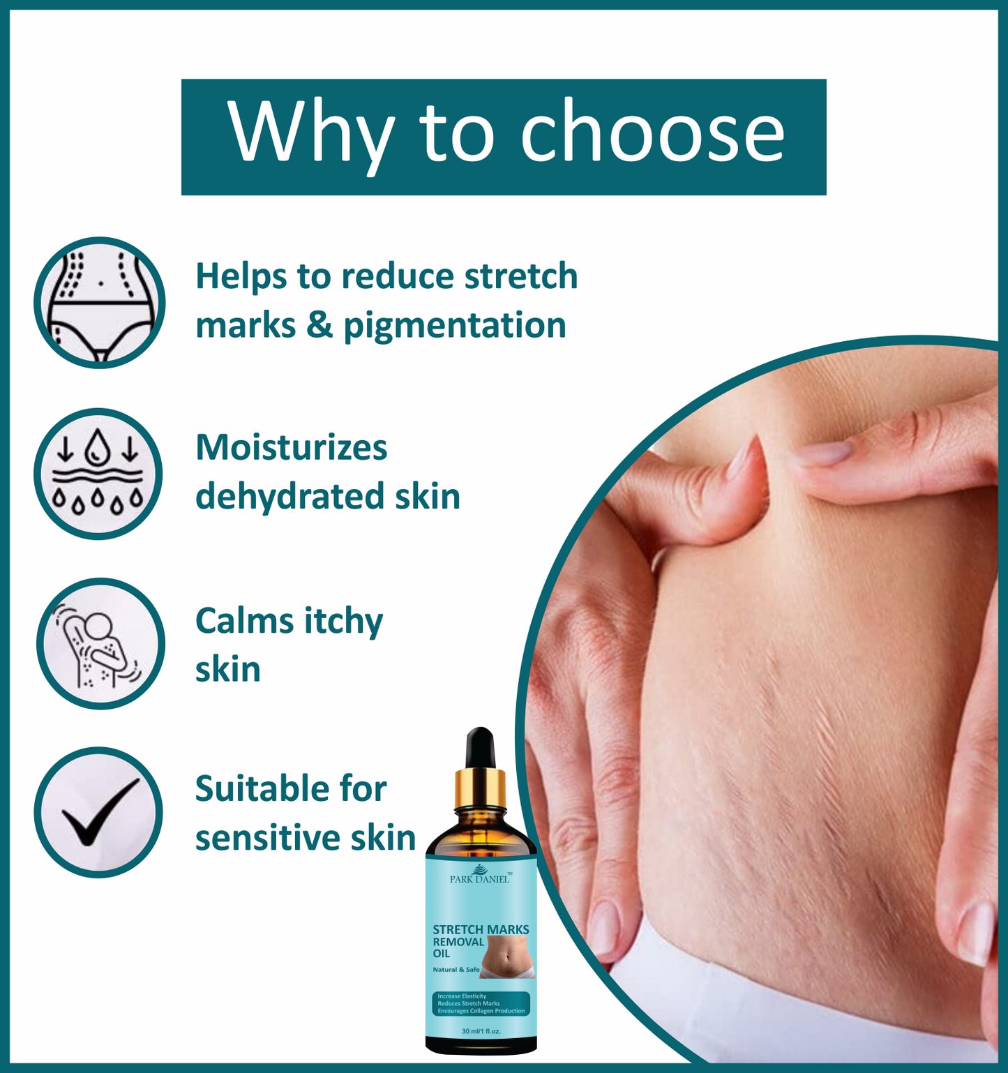 Premium Stretch Marks Removal Oil