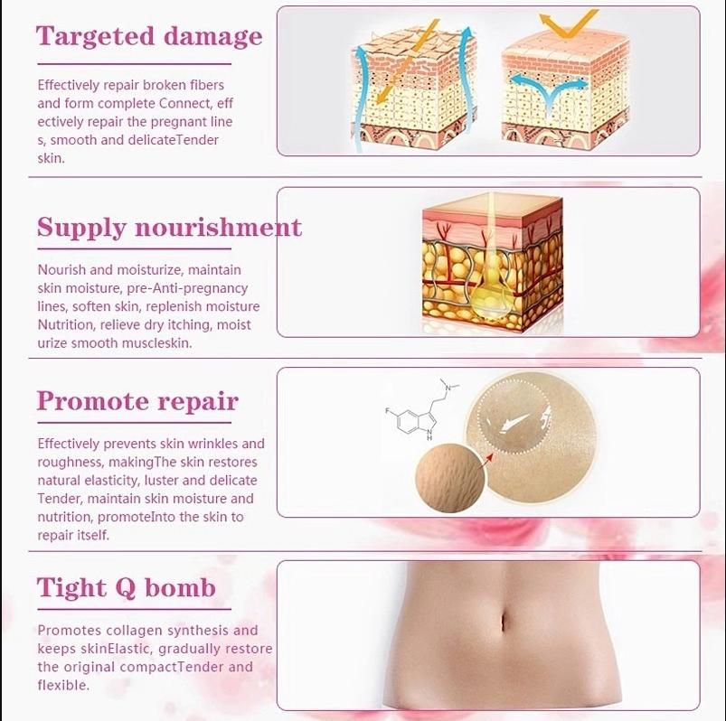 Pregnancy Stretch Marks Removal Oil