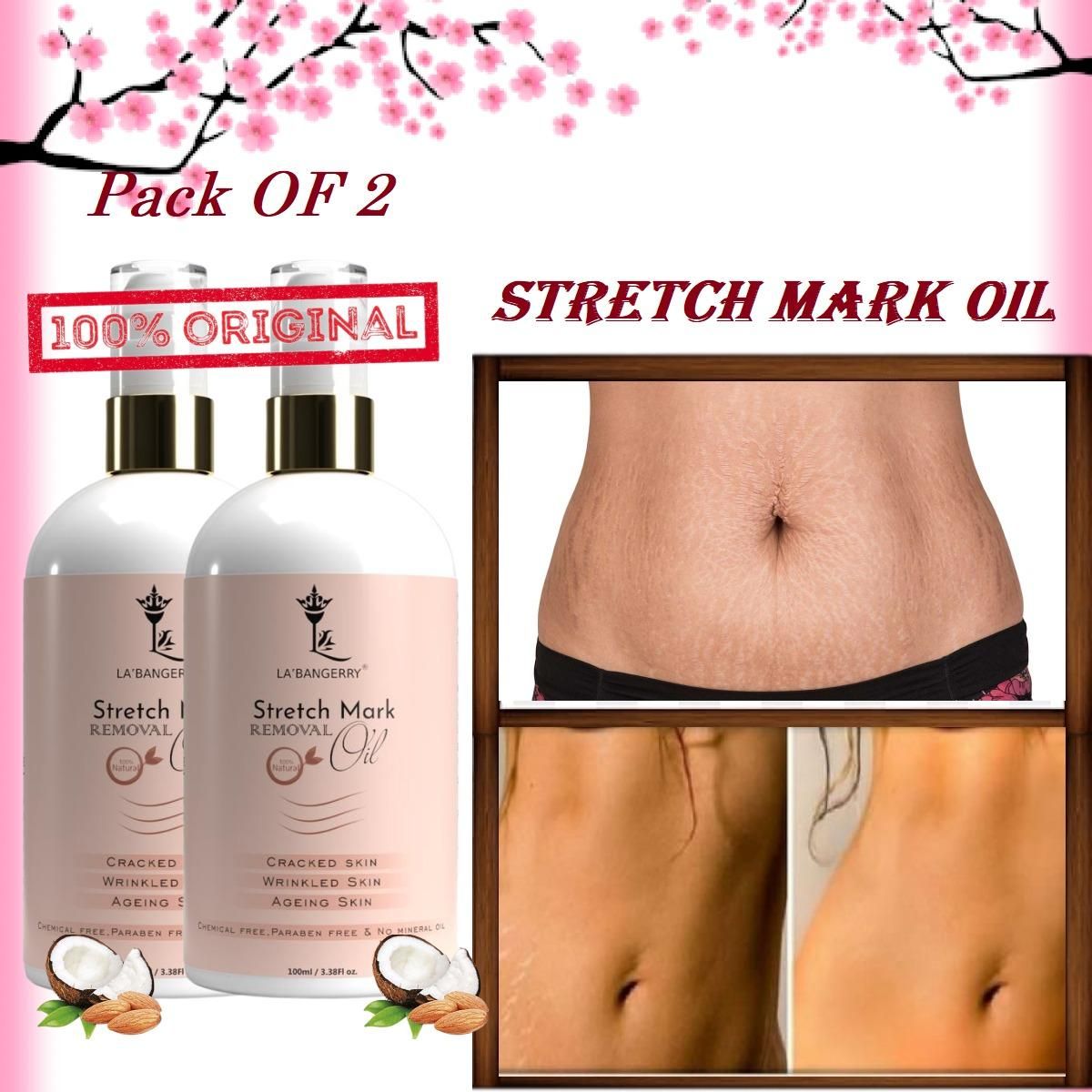 Stretch Marks Removal Oil (Pack of 2)