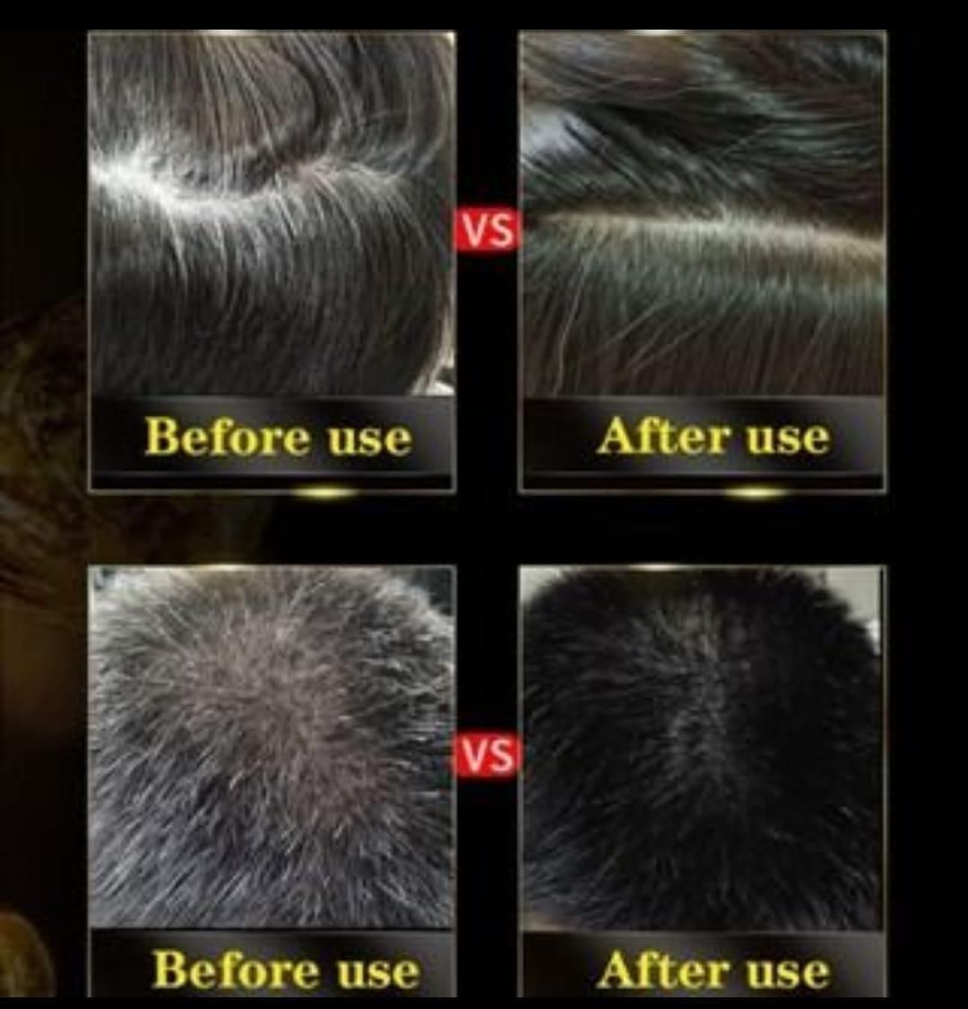 BLACK HAIR DYE SHAMPOO 3-IN-1 (NO SIDE EFFECT) - Buy 1 Get 1 Free 🔥