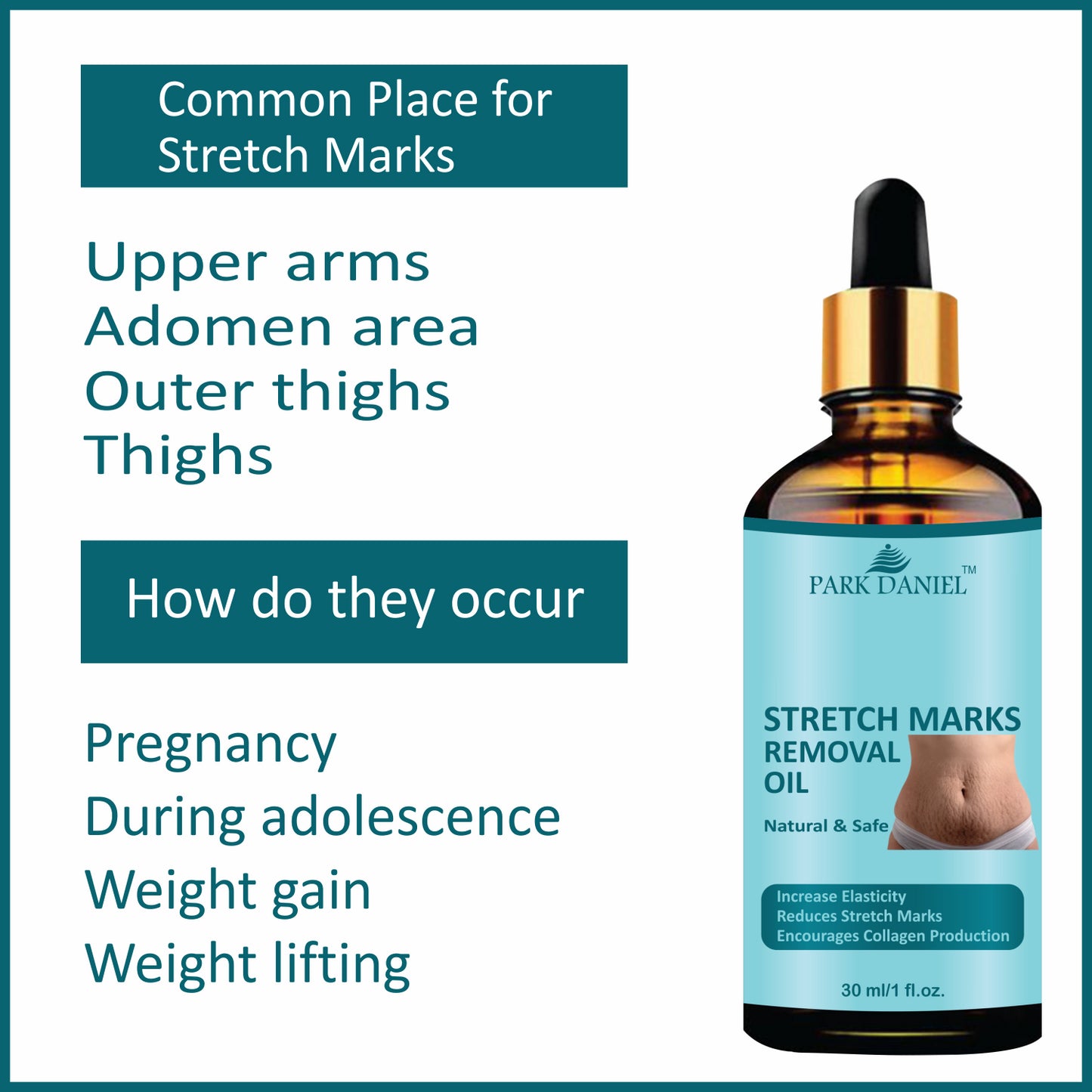 Premium Stretch Marks Removal Oil