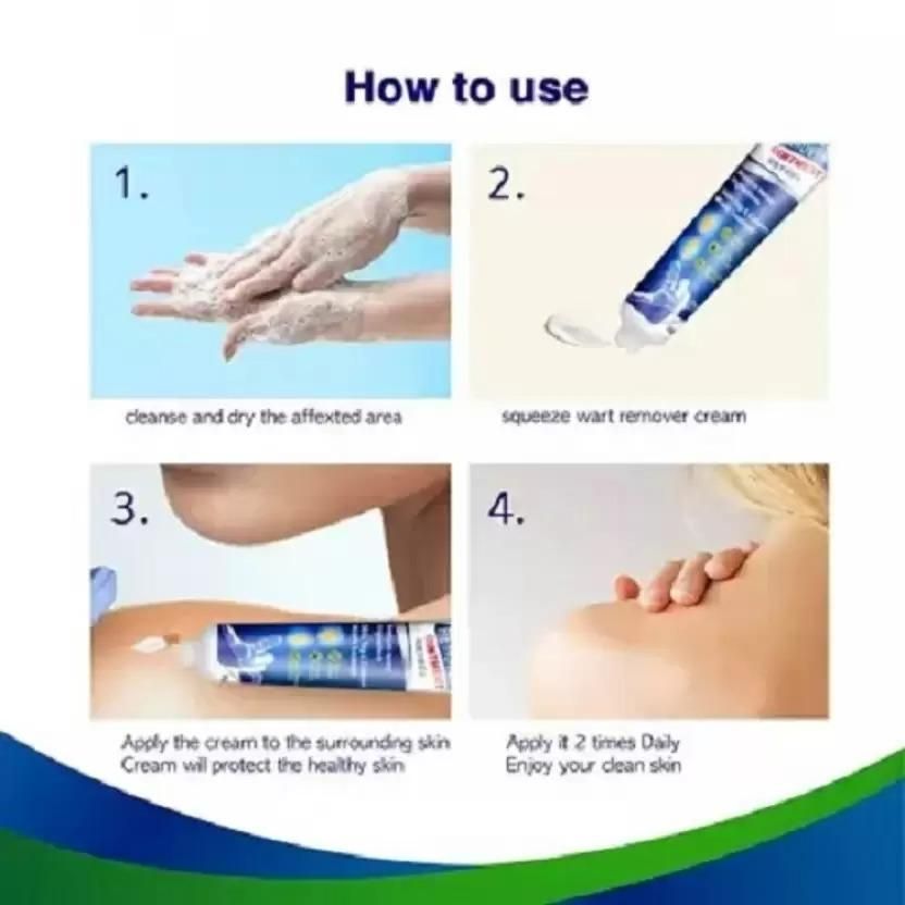 WartsOff Instant Blemish Removal Cream 