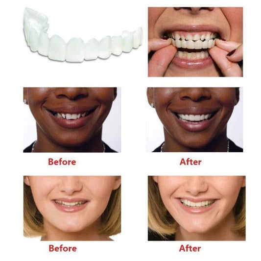 😍🦷Instant and Confident on Smile Fit Flex Cosmetic Teeth Denture Teeth😍🦷
