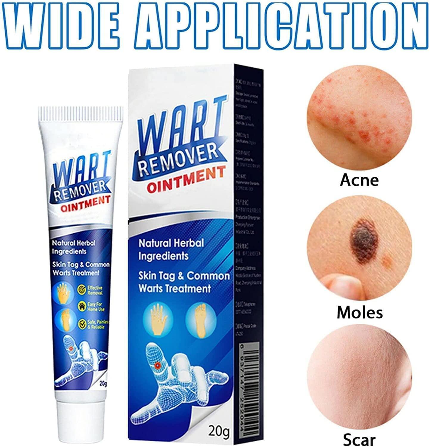 WartsOff Instant Blemish Removal Cream 