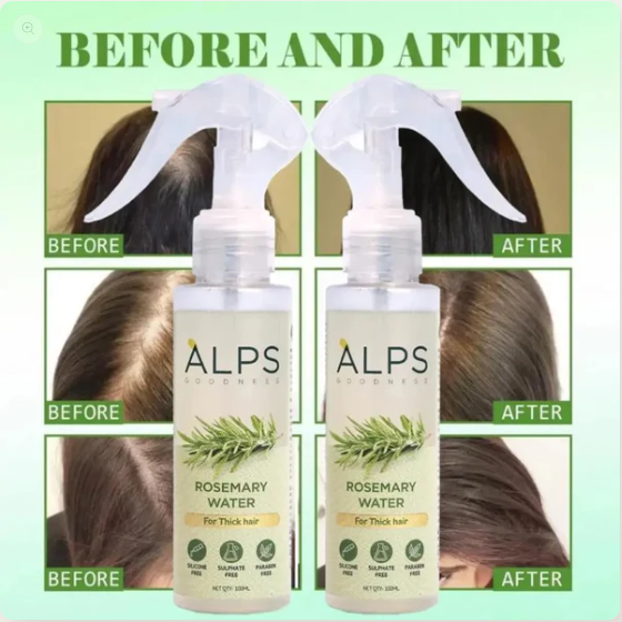 🤩Rosemary Water, Hair Spray For Regrowth[🔥BUY 1 FREE 1🔥]🤩