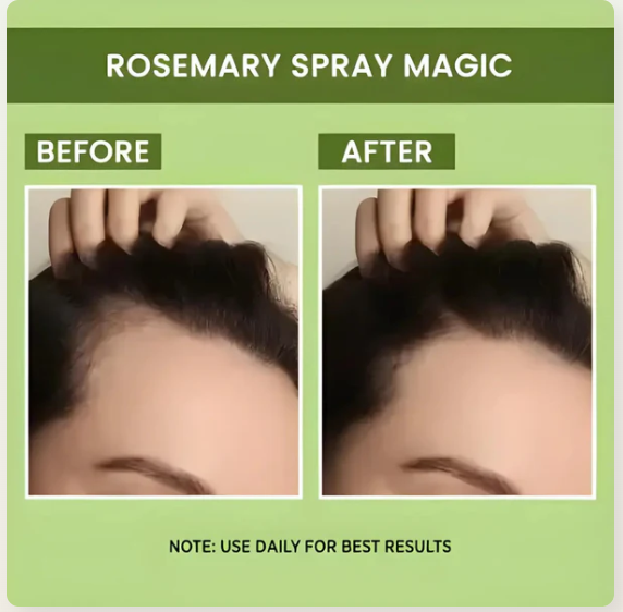 🤩Rosemary Water, Hair Spray For Regrowth[🔥BUY 1 FREE 1🔥]🤩