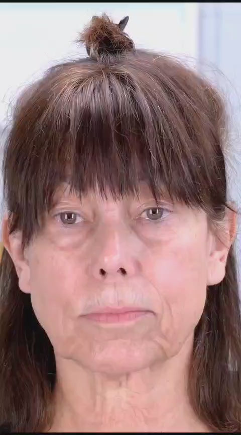 Face Lifting Tape