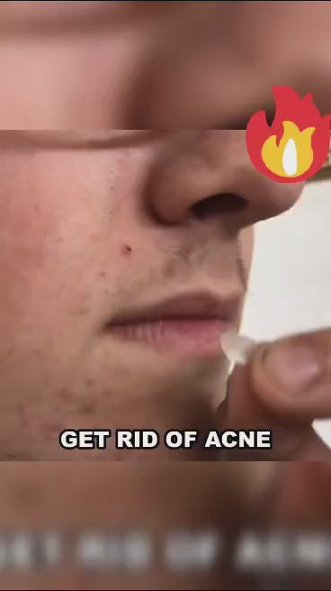 Acne Pimple Patch