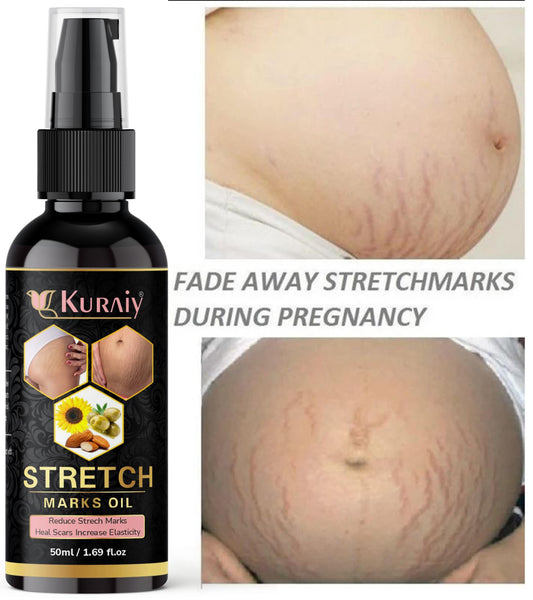 Pregnancy Stretch Marks Removal Oil