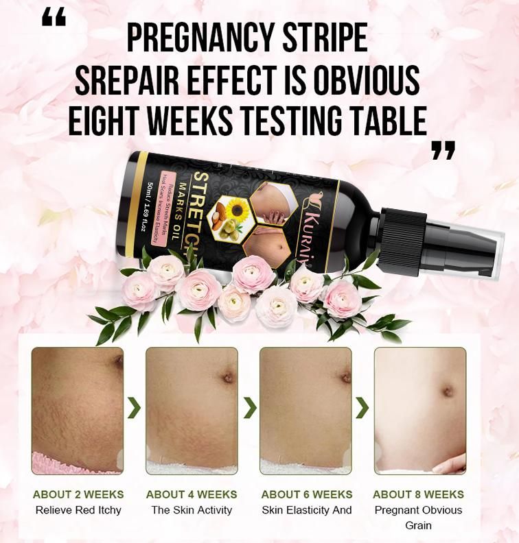 Pregnancy Stretch Marks Removal Oil
