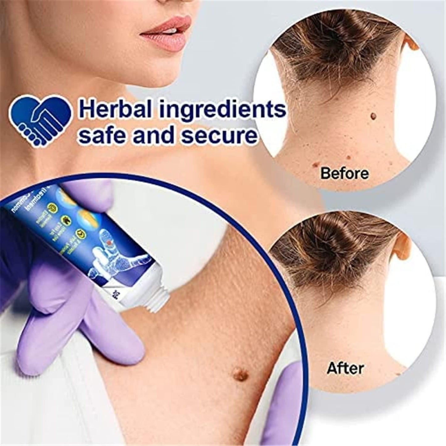 WartsOff Instant Blemish Removal Cream 